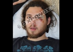 Ξυλοκόπησαν φοιτητή