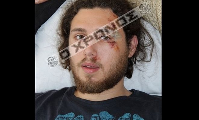 Ξυλοκόπησαν φοιτητή