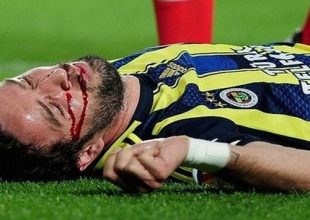 Ο ανατριχιαστικός τραυματισμός του Γιονούλ