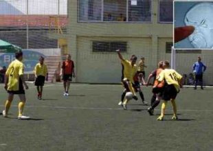 Έπαιξε σε ματς έχοντας μία σφαίρα σφηνωμένη στο κεφάλι του!