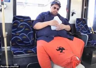 Του αφαίρεσαν όρχεις 60 κιλών(pics)