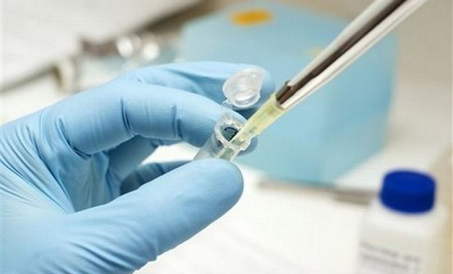 Πιθανή έκρηξη ηπατίτιδας C στην Ελλάδα