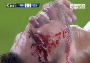 Ο σκληρός τραυματισμός του Πέπε (vid)