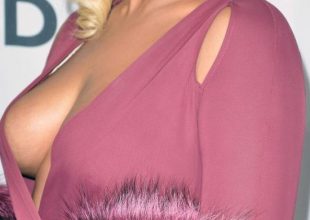 Η πλαστική που έκανε η Beyonce για χάρη του… Jay Z