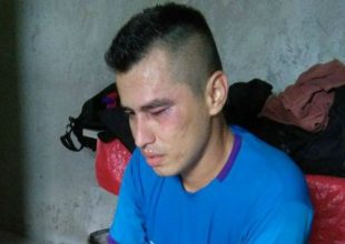 Ξάπλωσε τον διαιτητή με δεξί κροσέ! (Video)