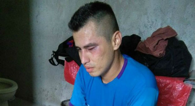 Ξάπλωσε τον διαιτητή με δεξί κροσέ! (Video) Ξάπλωσε τον διαιτητή με δεξί κροσέ! (Video)