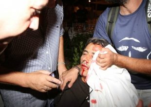 «Φοβήθηκα ότι θα έχανα το μάτι μου»
