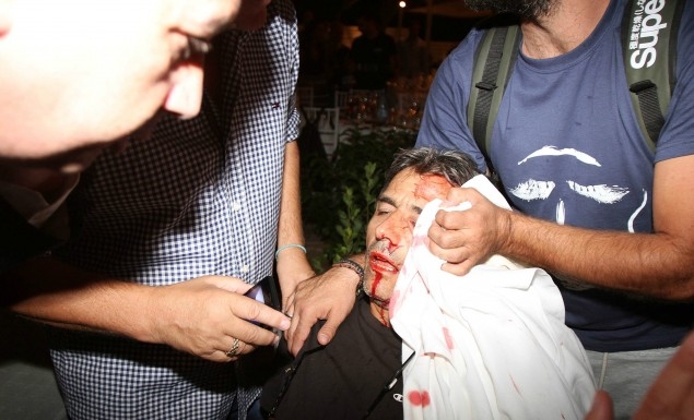 «Φοβήθηκα ότι θα έχανα το μάτι μου»