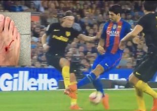 Σουάρες σε Φελίπε Λουίς: “Το ποδόσφαιρο είναι για άντρες”!