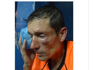 Διαιτητής έφαγε το ξύλο της αρκούδας στην Αργεντινή (vid)