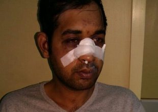 Νέα ρατσιστική επίθεση σε εργαζόμενο μετανάστη