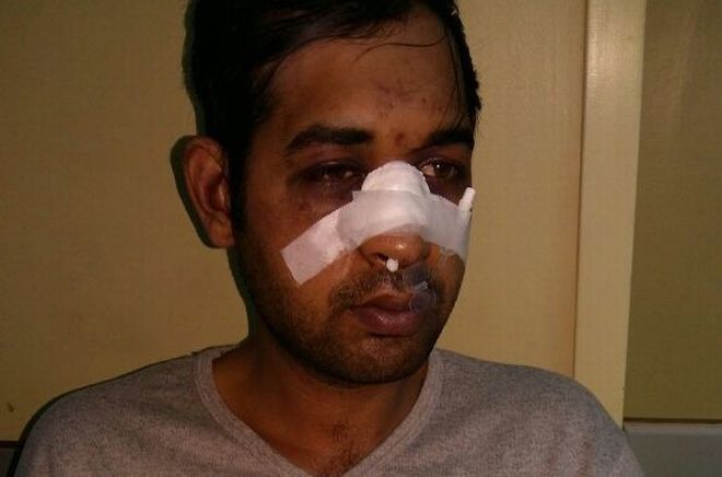 Νέα ρατσιστική επίθεση σε εργαζόμενο μετανάστη