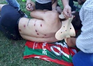 Αστυνομικοί “γάζωσαν” παίκτες με πλαστικές σφαίρες!