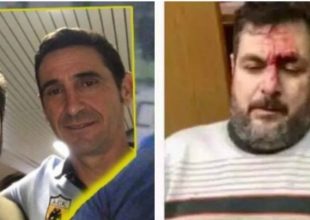 Ζούγκλα: Επιτέθηκαν στον φίλο της ΑΕΚ Γαρύφαλλου (PIC)
