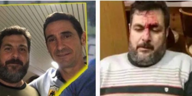 Ζούγκλα: Επιτέθηκαν στον φίλο της ΑΕΚ Γαρύφαλλου (PIC)