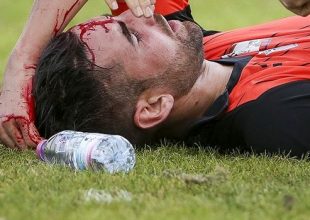 Κέρκυρα – Ξάνθη: Έκανε οκτώ ράμματα στο κεφάλι ο Κάστρο (PHOTO)