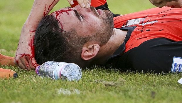 Κέρκυρα – Ξάνθη: Έκανε οκτώ ράμματα στο κεφάλι ο Κάστρο (PHOTO)