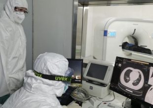 Κορονοϊός: Θετικός ο πρόεδρος της Μπρέσια