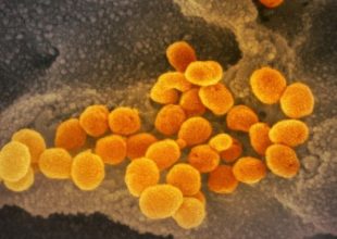 Κορωνοϊός: Σπουδαία ανακάλυψη – Ερευνητές απομόνωσαν ένζυμο πολλαπλασιασμού