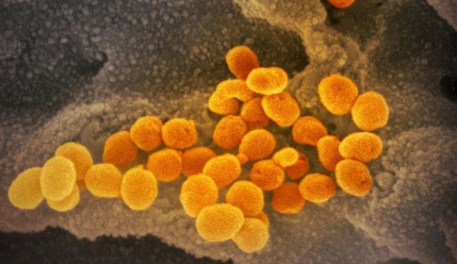 Κορωνοϊός: Σπουδαία ανακάλυψη – Ερευνητές απομόνωσαν ένζυμο πολλαπλασιασμού Κορωνοϊός: Σπουδαία ανακάλυψη – Ερευνητές απομόνωσαν ένζυμο πολλαπλασιασμού