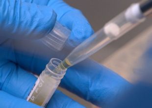 Κορωνοϊός: Αποτελεσματικό αποδεικνύεται φτηνό φάρμακο για την ελονοσία