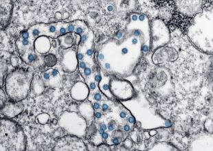 Θετική εξέλιξη: Ο κορωνοϊός δεν φαίνεται να μεταλλάσσεται γρήγορα