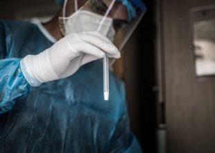 Κορωνοϊός:  3316 νέα κρούσματα – 50 νέοι θάνατοι