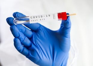 Κορωνοϊός: Στην Ελλάδα τα πρώτα self test απόψε το βραδυ