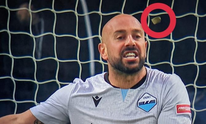 Κέρμα χτύπησε στο κεφάλι τον Ρέινα Κέρμα χτύπησε στο κεφάλι τον Ρέινα