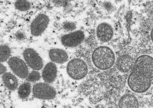 Εξαπλώνεται η Ευλογιά των Πιθήκων: Πάνω από 6.000 κρούσματα σε 58 χώρες