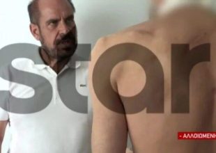 «Κρατούσαν λοστάρια, ρόπαλα – Έφαγα μία στο κεφάλι και έπεσα κάτω, ζω από θαύμα»