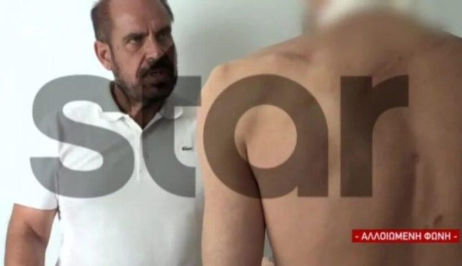 «Κρατούσαν λοστάρια, ρόπαλα – Έφαγα μία στο κεφάλι και έπεσα κάτω, ζω από θαύμα»
