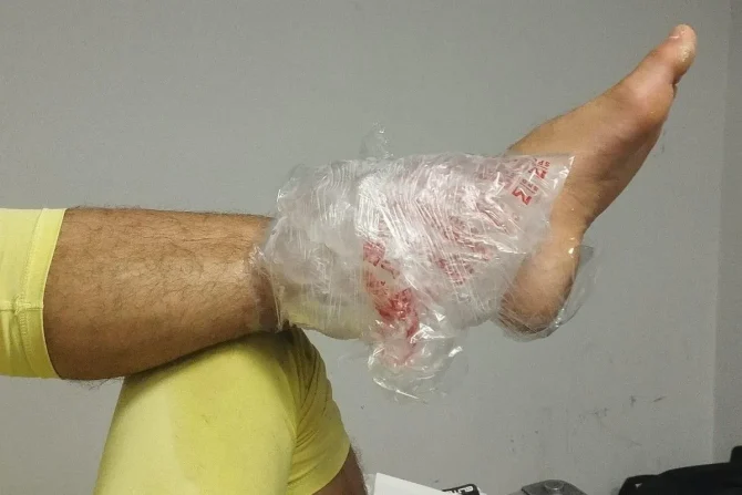 Ολυμπιακός: Με πάγο στον αστράγαλο ο Τζολάκης, λόγω χτυπήματος στη φάση που απέκρουσε το σουτ του Γερεμέγεφ